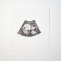 Ultrasound